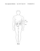 Light Therapy for Increasing CD34+ Cell Count in Peripheral Blood diagram and image