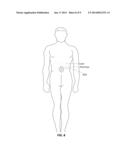 Light Therapy for Increasing CD34+ Cell Count in Peripheral Blood diagram and image