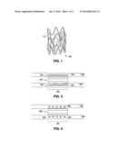 METHODS OF TREATMENT WITH BIODEGRADATION OF A STENT SCAFFOLDING diagram and image