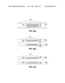 METHODS OF TREATMENT WITH BIODEGRADATION OF A STENT SCAFFOLDING diagram and image