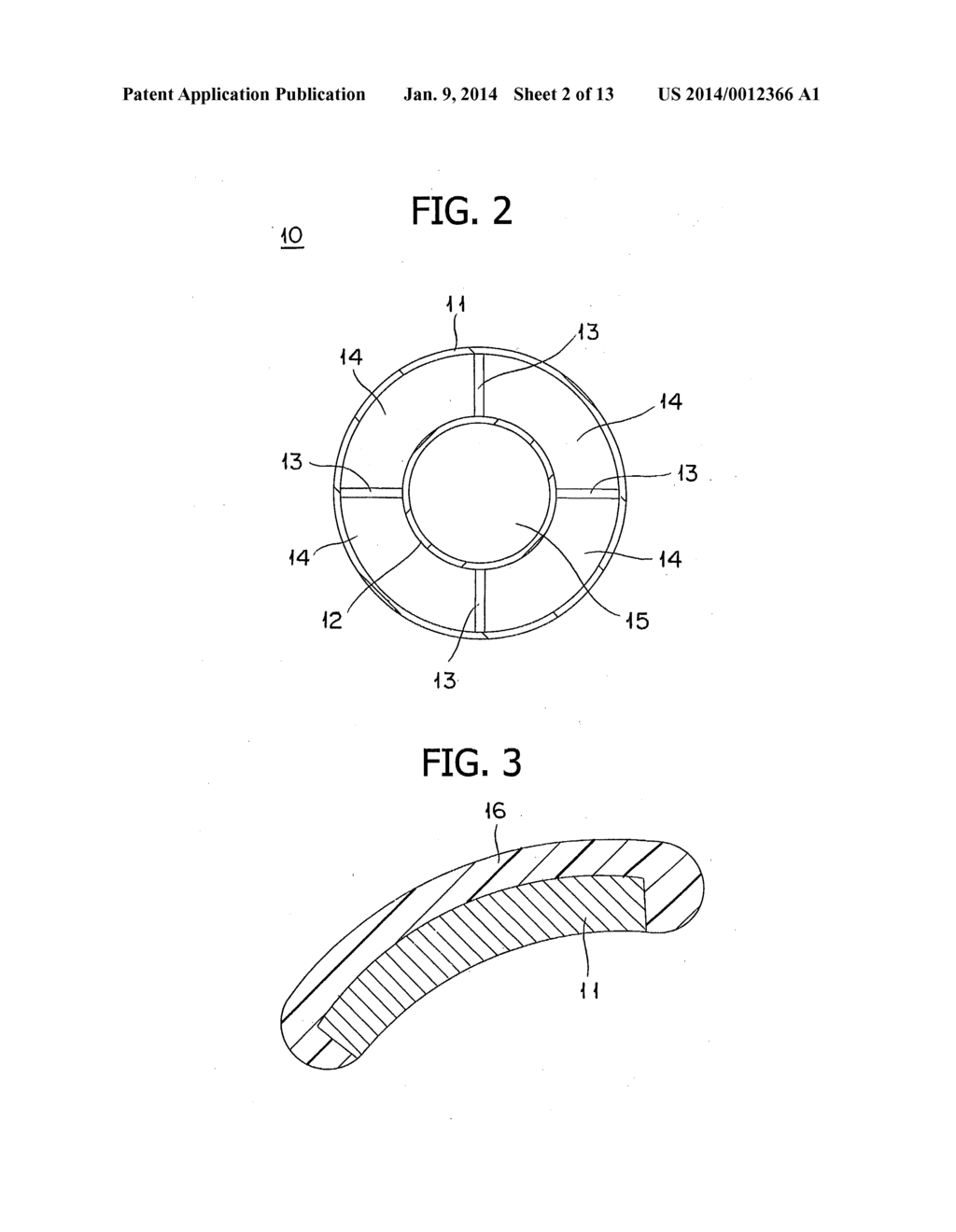 STENT - diagram, schematic, and image 03