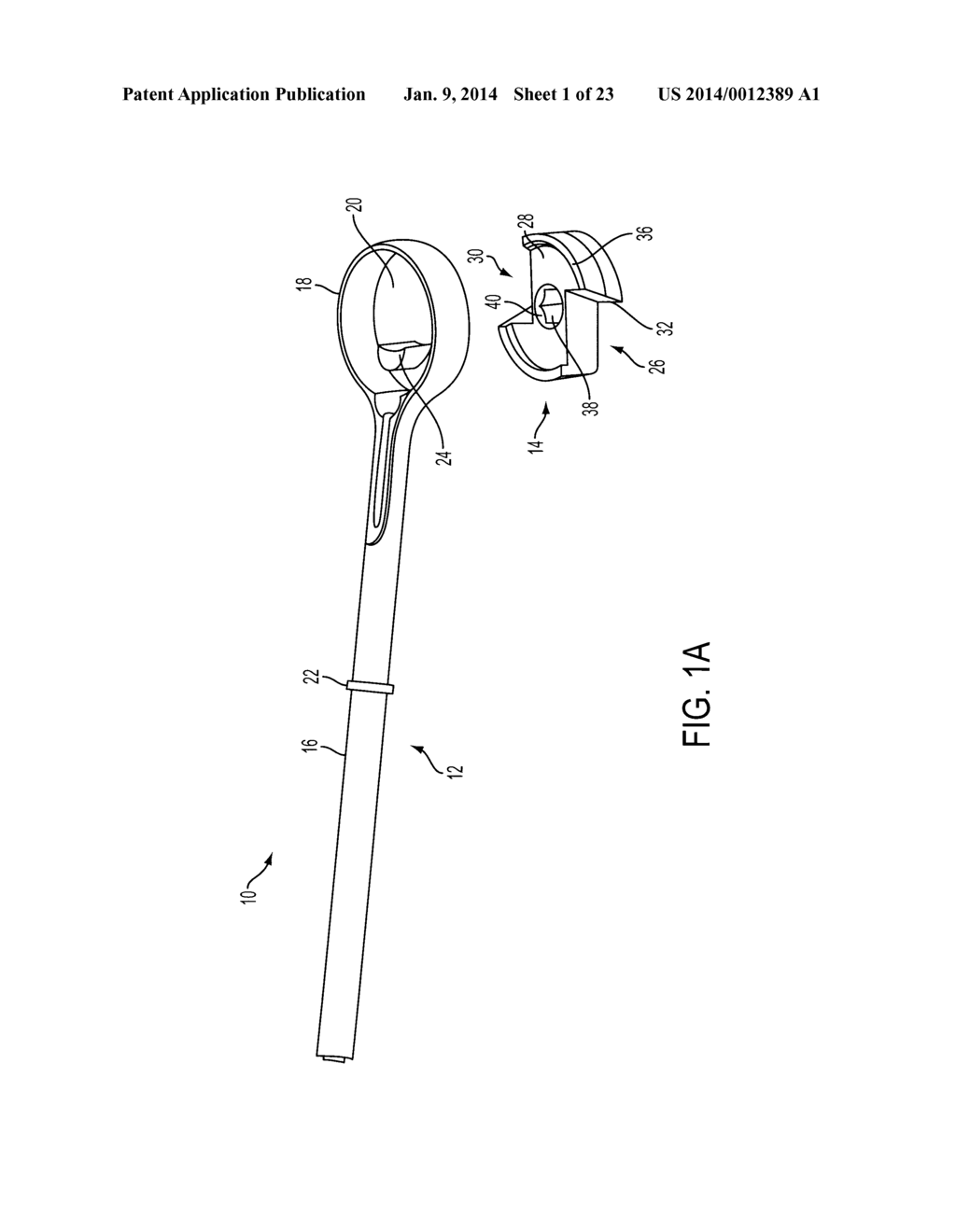 System for Articular Surface Replacement - diagram, schematic, and image 02