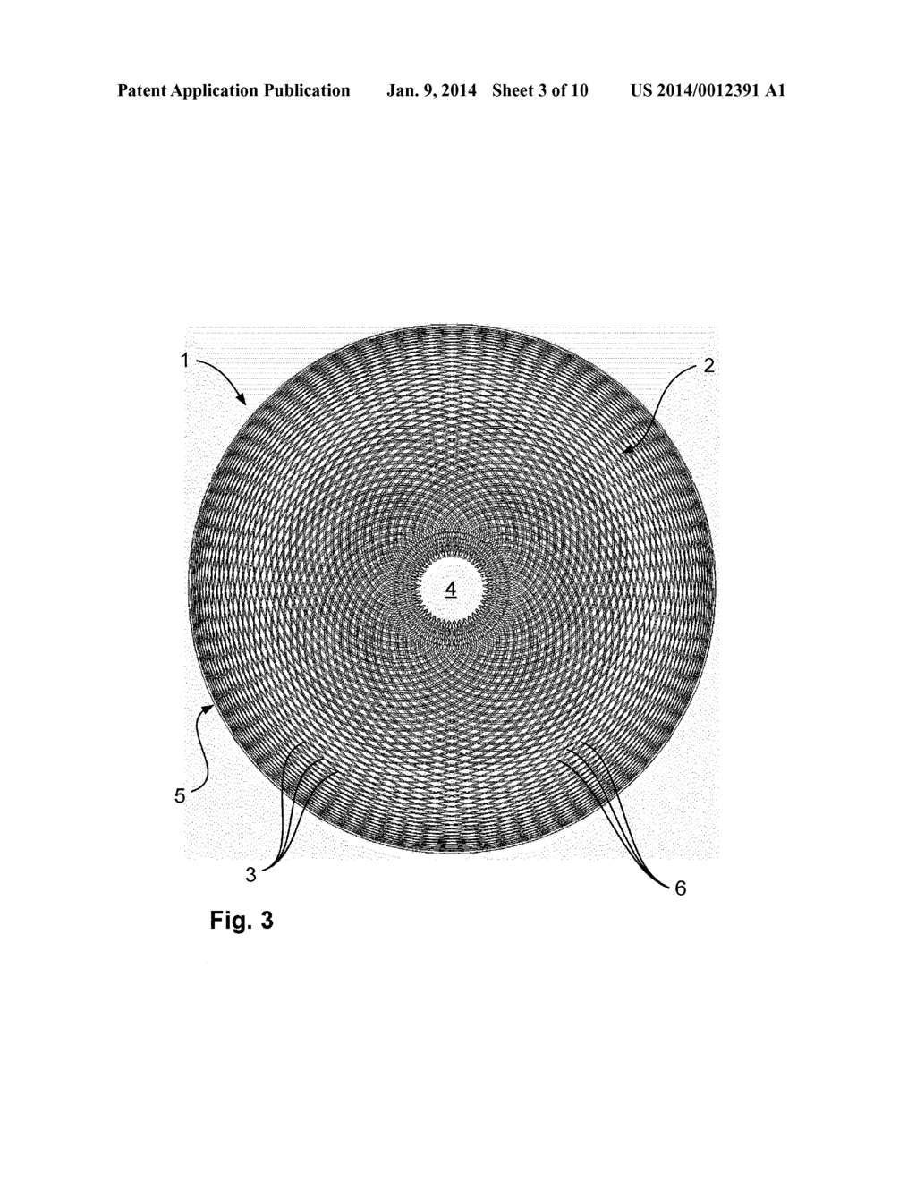 Joint Socket Implant - diagram, schematic, and image 04