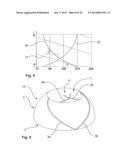 Joint Socket Implant diagram and image