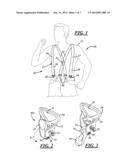 TWO FASTENER SUSPENDERS diagram and image