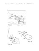 BAIT BRIDLE diagram and image