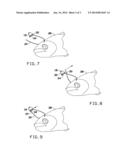 BAIT BRIDLE diagram and image