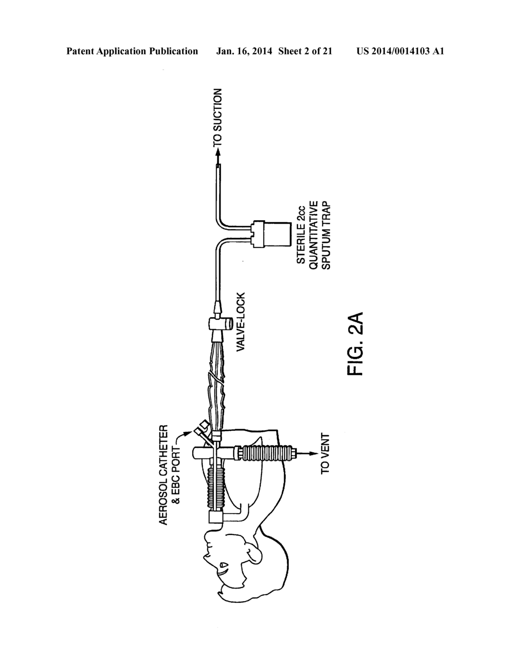 Methods, Devices and Formulations for Targeted Endobronchial Therapy - diagram, schematic, and image 03