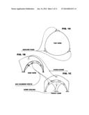 WEATHER DOME diagram and image