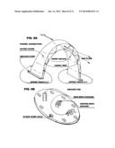 WEATHER DOME diagram and image