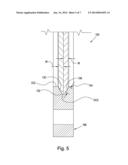 ONE WAY WEDGE CLUTCH WITH REDUCED FREEWHEEL FRICTION diagram and image