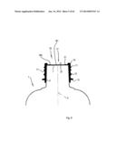 COMPRESSION MOULDING APPARATUSES AND METHODS diagram and image