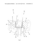 COMPRESSION MOULDING APPARATUSES AND METHODS diagram and image