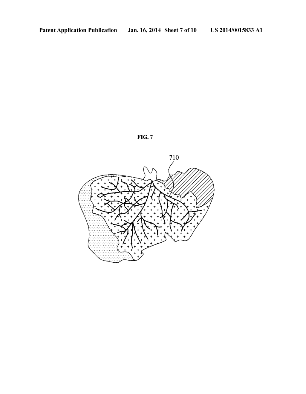 METHOD AND APPARATUS FOR CREATING MODEL OF PATIENT SPECIFIED TARGET ORGAN - diagram, schematic, and image 08