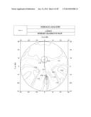 PROGRESSIVE OPHTHALMIC LENS diagram and image