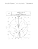 PROGRESSIVE OPHTHALMIC LENS diagram and image