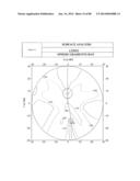 PROGRESSIVE OPHTHALMIC LENS diagram and image