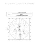 PROGRESSIVE OPHTHALMIC LENS diagram and image