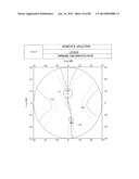 PROGRESSIVE OPHTHALMIC LENS diagram and image