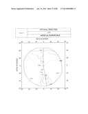 PROGRESSIVE OPHTHALMIC LENS diagram and image