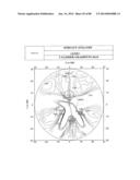 PROGRESSIVE OPHTHALMIC LENS diagram and image