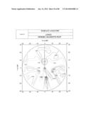 PROGRESSIVE OPHTHALMIC LENS diagram and image