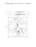 PROGRESSIVE OPHTHALMIC LENS diagram and image