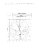 PROGRESSIVE OPHTHALMIC LENS diagram and image