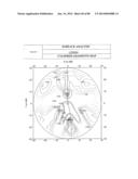 PROGRESSIVE OPHTHALMIC LENS diagram and image