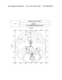 PROGRESSIVE OPHTHALMIC LENS diagram and image