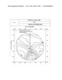 PROGRESSIVE OPHTHALMIC LENS diagram and image