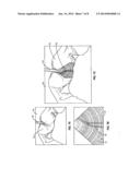 SYSTEM AND METHOD OF PROVIDING REAL-TIME DYNAMIC IMAGERY OF A MEDICAL     PROCEDURE SITE USING MULTIPLE MODALITIES diagram and image