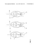 FACIAL ANALYSIS TO DETECT ASYMMETRIC EXPRESSIONS diagram and image