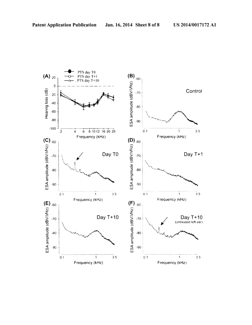 METHODS FOR THE TREATMENT OF TINNITUS INDUCED BY COCHLEAR EXCITOTOXICITY - diagram, schematic, and image 09