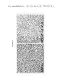 Transfection of Mesothelium Body Cavity Lining with Gene Agents Followed     by Chemotharapy to Treat Cancer of Organs in the Body Cavity diagram and image