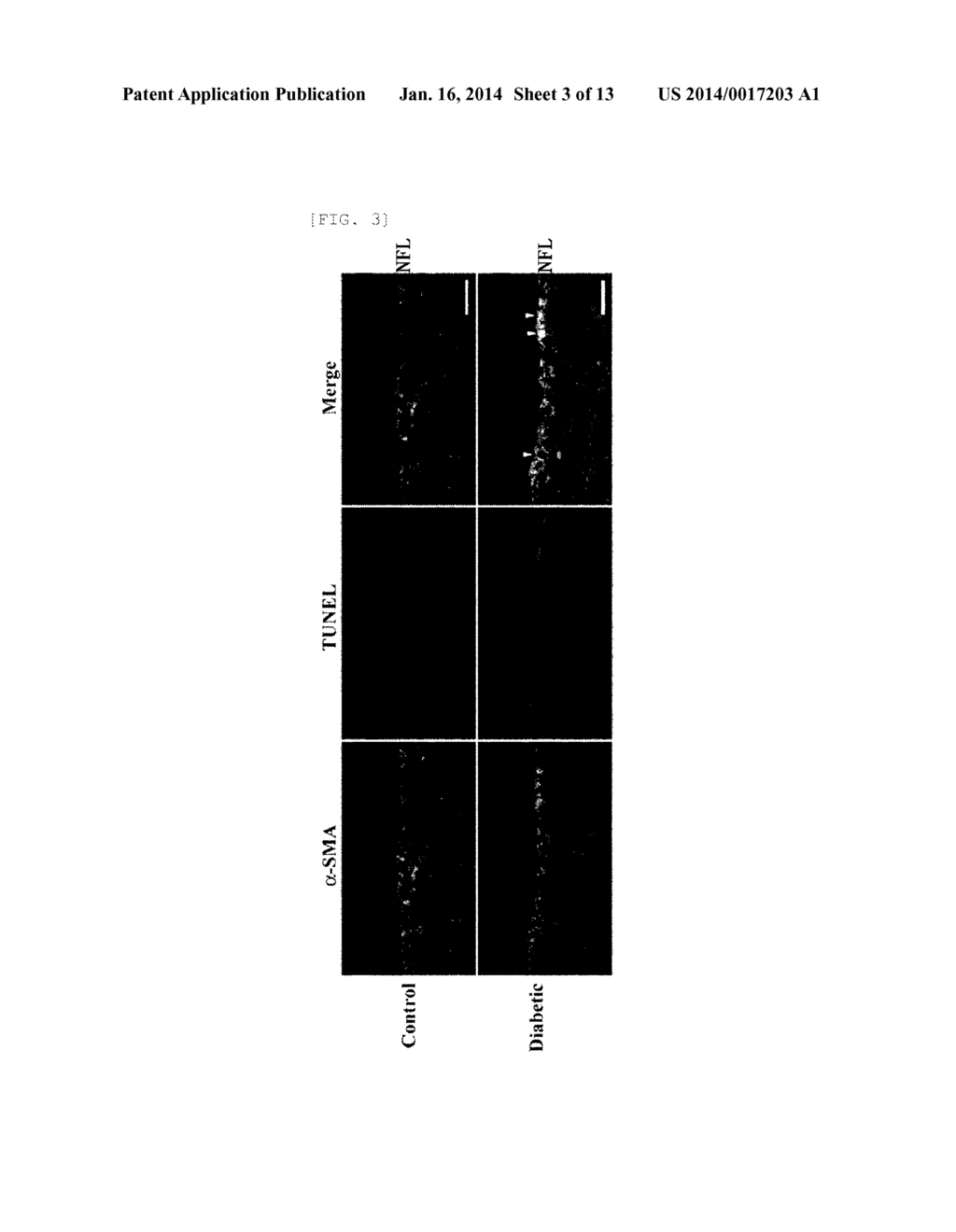 RECOMBINANT ADENOVIRUS EXPRESSING ALPHA-A-CRYSTALLIN GENE AND GENE THERAPY     FOR RETINALVASCULAR DISEASE USING THE SAME - diagram, schematic, and image 04