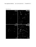 GENE SIGNATURES FOR USE WITH HEPATOCELLULAR CARCINOMA diagram and image