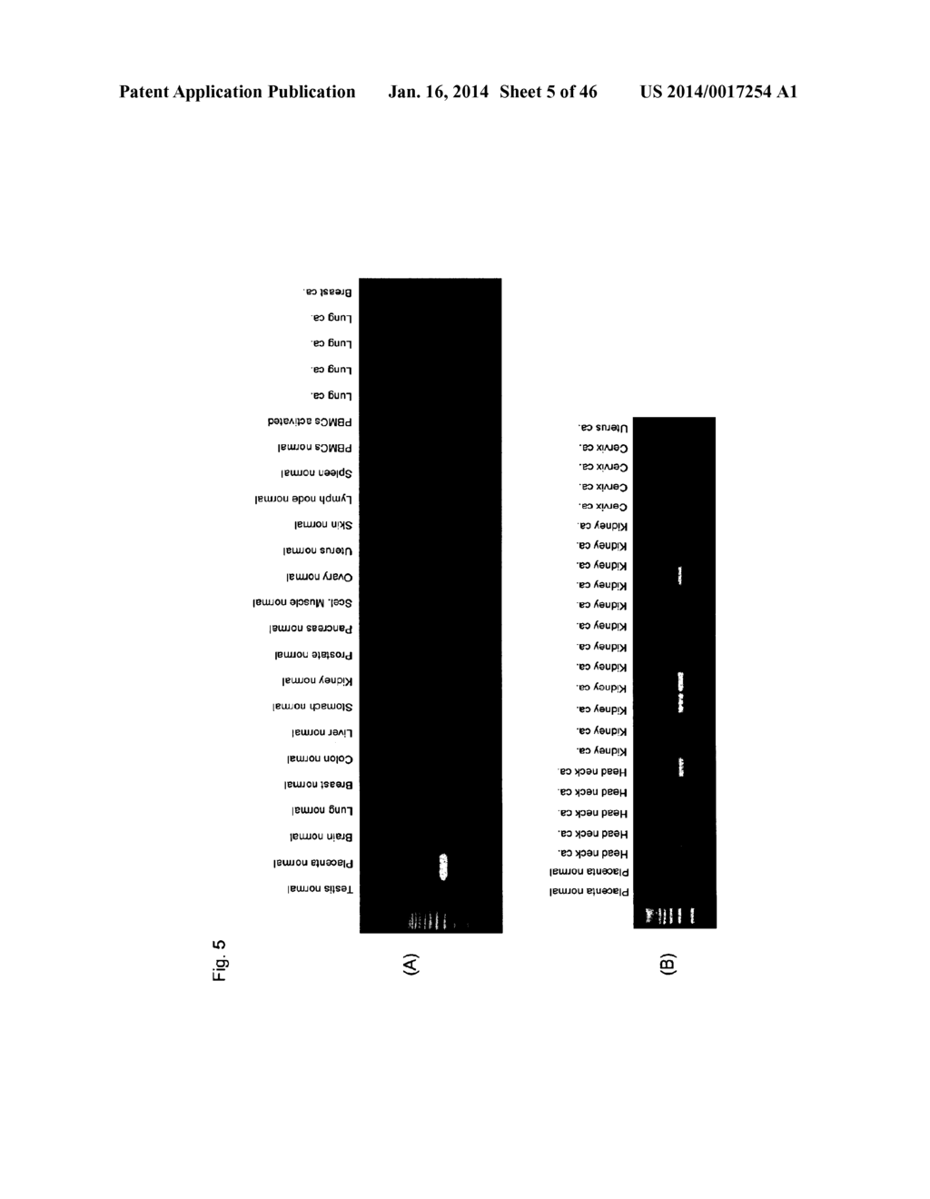 Identification of Tumor-Associated Antigens for Diagnosis and Therapy - diagram, schematic, and image 06