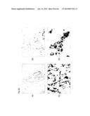 Identification of Tumor-Associated Antigens for Diagnosis and Therapy diagram and image