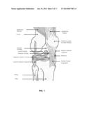 PORATED CARTILAGE PRODUCTS diagram and image