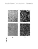 IDENTIFICATION OF SURFACE-ASSOCIATED ANTIGENS FOR TUMOR DIAGNOSIS AND     THERAPY diagram and image