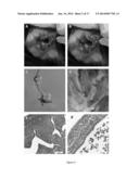 BIOMARKERS FOR ACUTE KIDNEY INJURY diagram and image