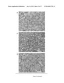 BIOMARKERS FOR ACUTE KIDNEY INJURY diagram and image