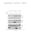 BIOMARKERS FOR ACUTE KIDNEY INJURY diagram and image