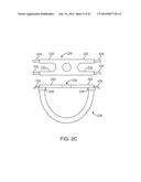 DEVICE FOR THE COLLECTION, REFINEMENT, AND ADMINISTRATION OF     GASTROINTESTINAL MICROFLORA diagram and image