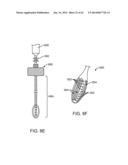 DEVICE FOR THE COLLECTION, REFINEMENT, AND ADMINISTRATION OF     GASTROINTESTINAL MICROFLORA diagram and image