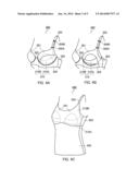 Garment with Cup Portions diagram and image