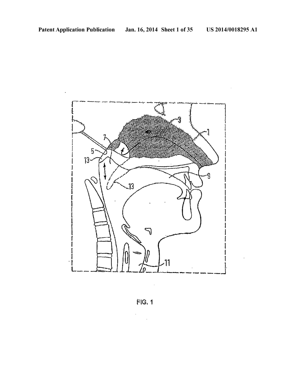 NASAL DELIVERY - diagram, schematic, and image 02