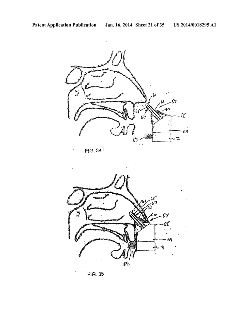 NASAL DELIVERY - diagram, schematic, and image 22