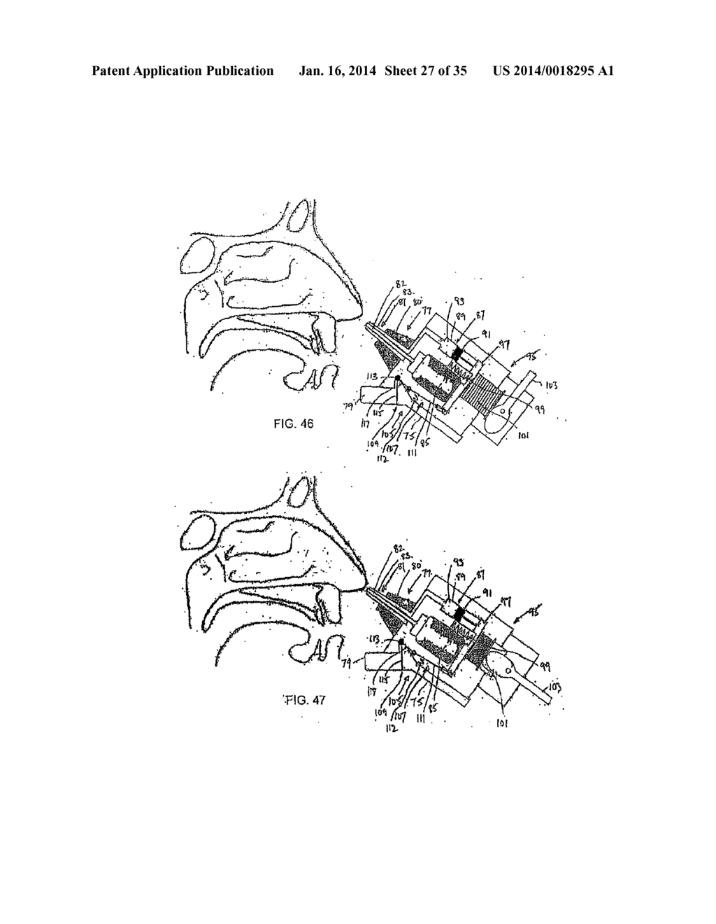 NASAL DELIVERY - diagram, schematic, and image 28